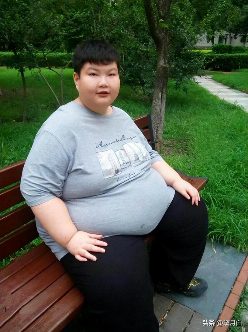 14岁江西男孩重达300斤，一顿能吃八碗饭，离世前痛哭：我要减肥  第14张