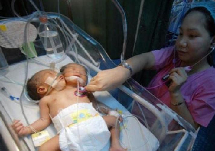 2011年，四川孕妇生下一对“双头女婴”，后想放弃抚养权再生一个  第4张
